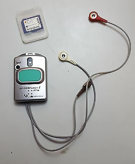 External monitor for detecting AF monitors over a 30-day period. 