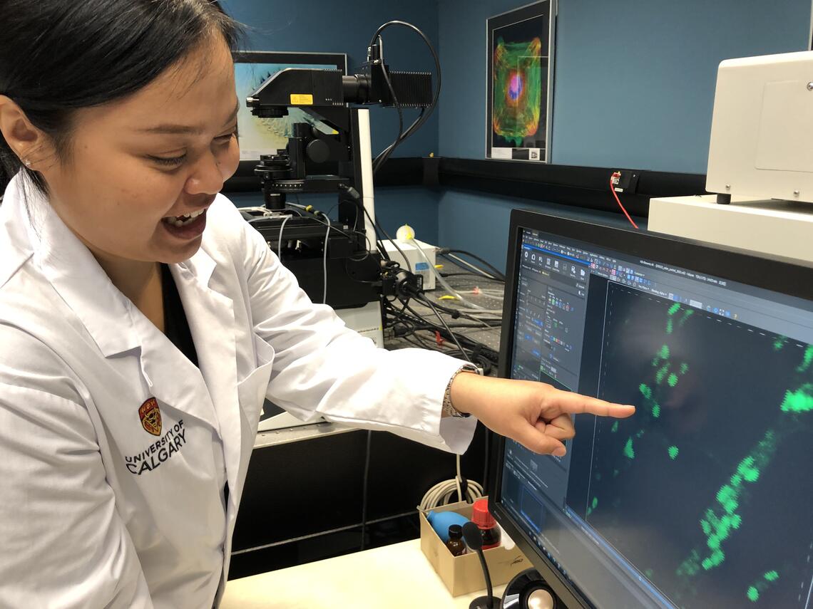 Preedajit Wongkrasant is observing the activity of neurons in the gut’s enteric nervous system