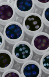 Photo: Images of genes (red, green, and blue spots within the nuclei of HeLa cells) are artificially superimposed on images of multi-well plates. Creator: Tom Misteli, Sigal Shachar, Murali Palangat. National Cancer Institute on Unsplash, January 15, 2020. 