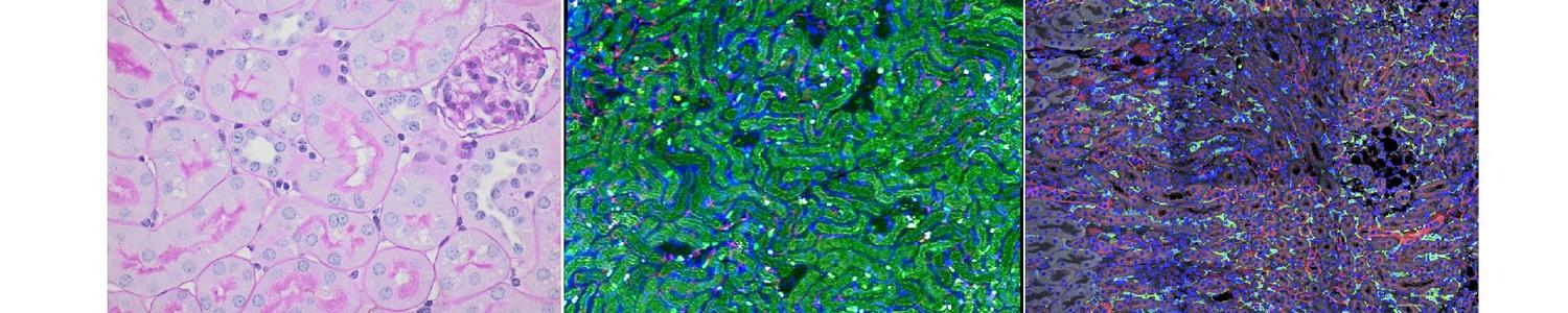 Renal Tubular Epithelial Cells by Dr. Lau