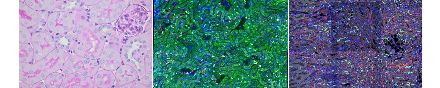 Renal Tubular Epithelial Cells by Dr. Lau