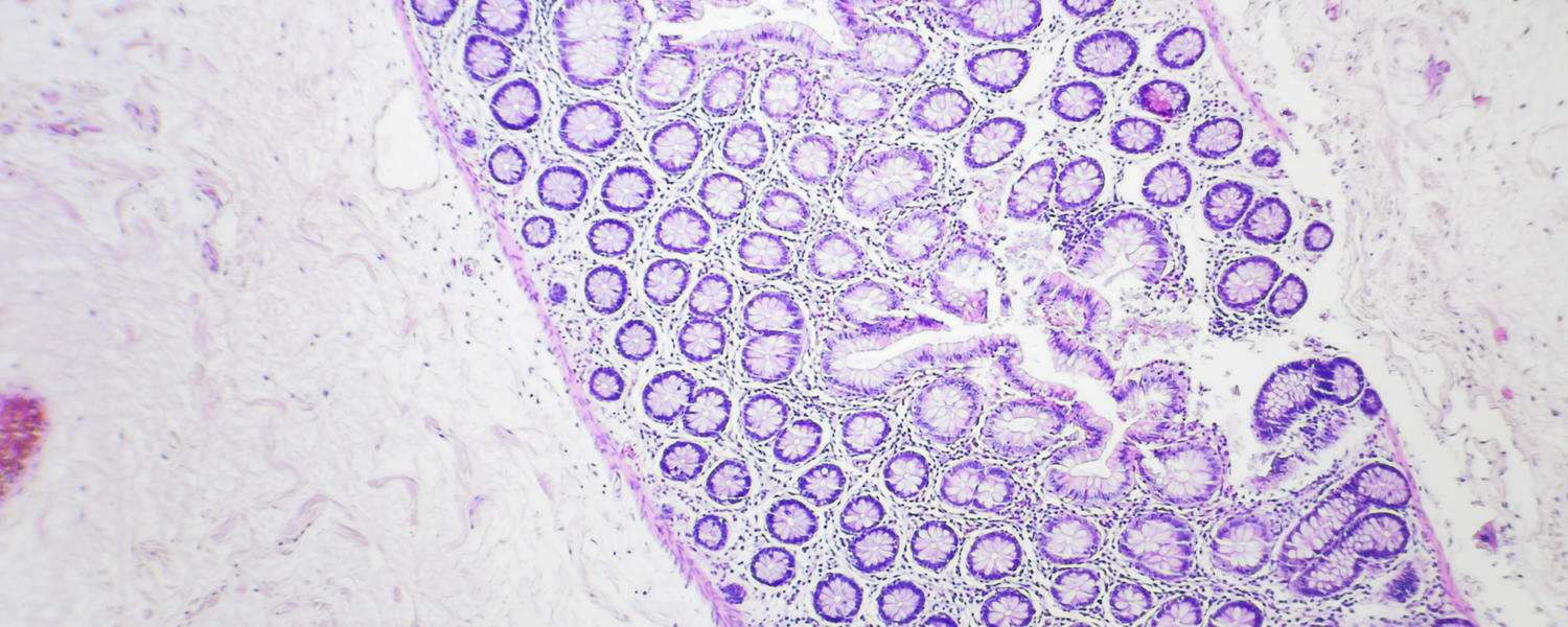 IBD