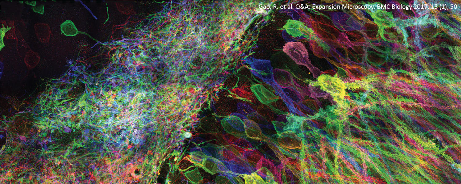 Expansion Microscopy