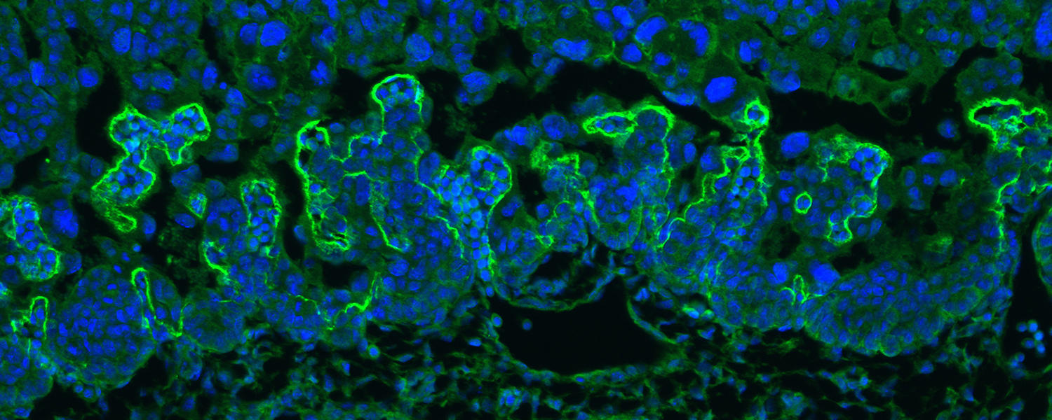 Transport surface of the mouse placenta, stained for MCT4 (green)