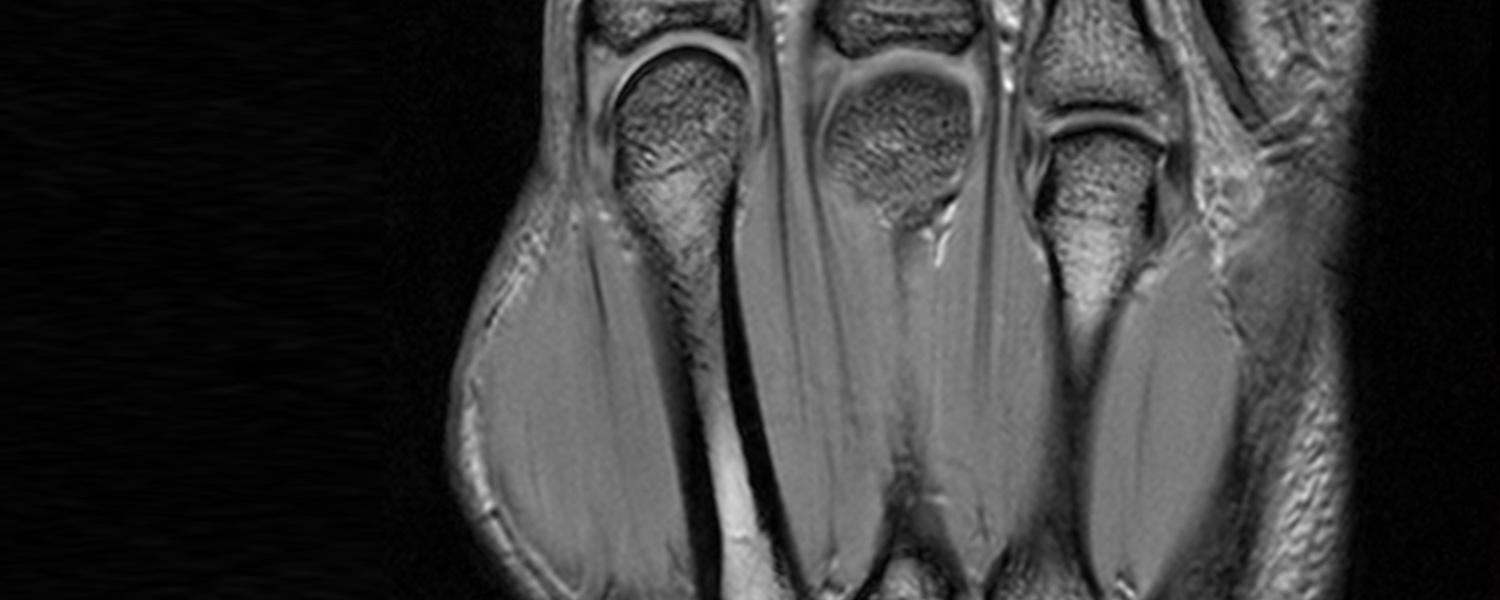 Musculoskeletal Imaging Fellowship