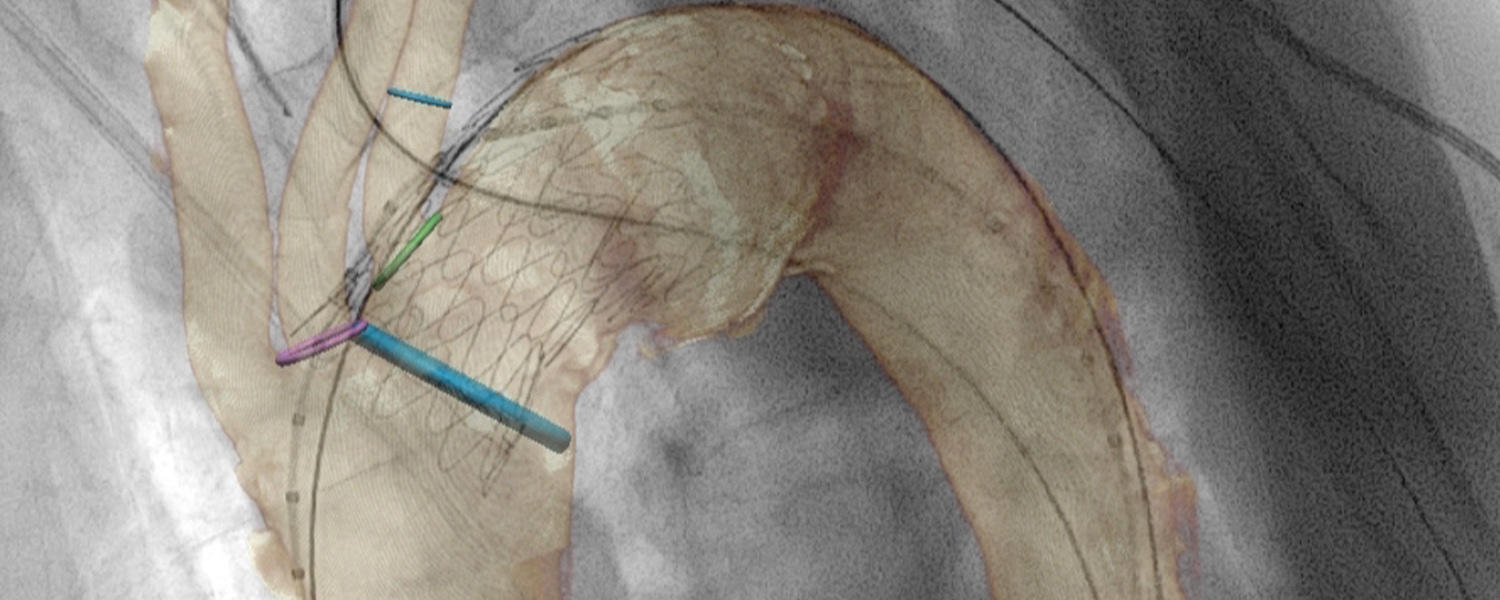 Body Interventional Fellowship