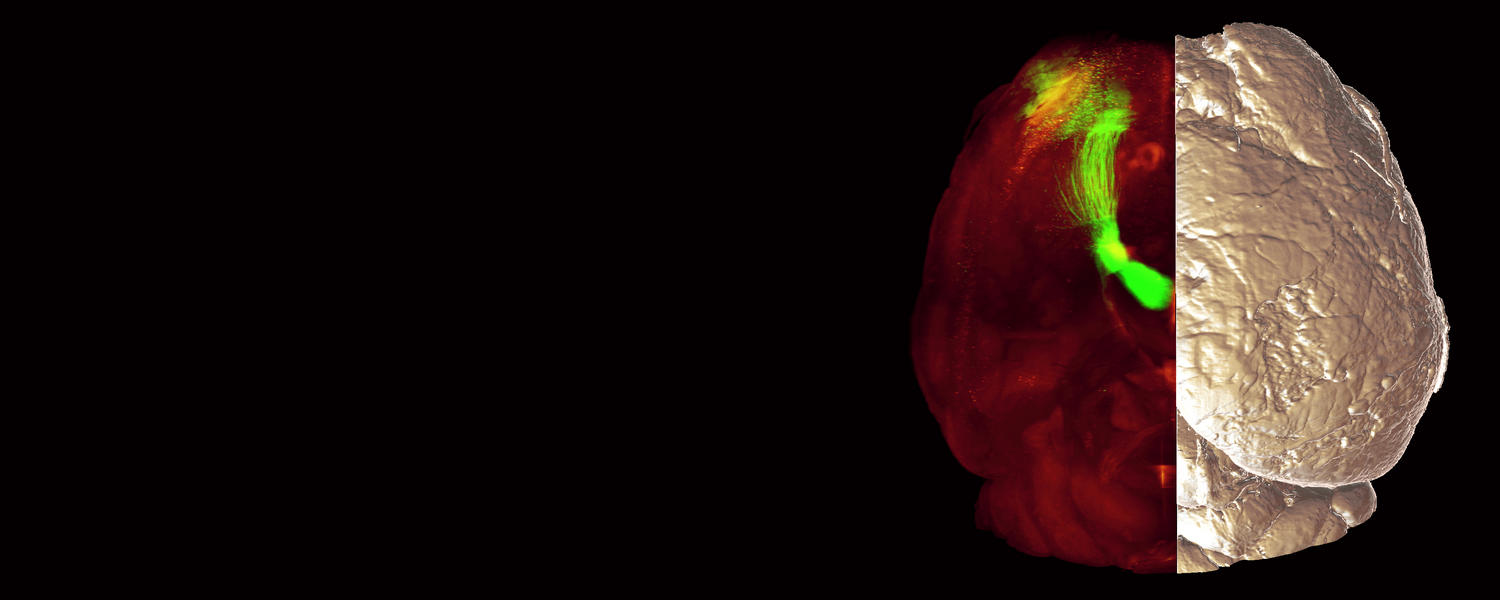linda brain banner