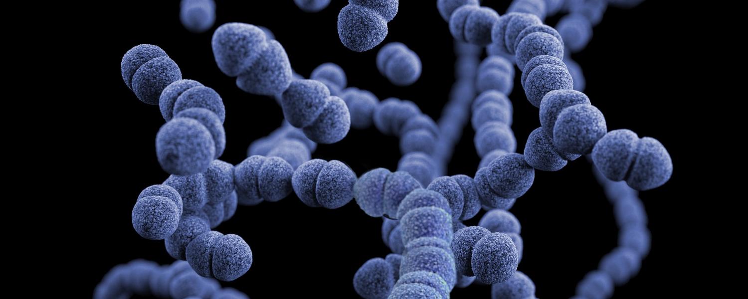 Sepsis