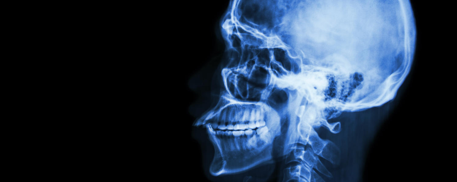 Head xray