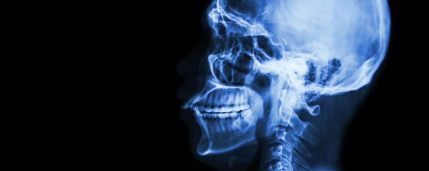 Head xray