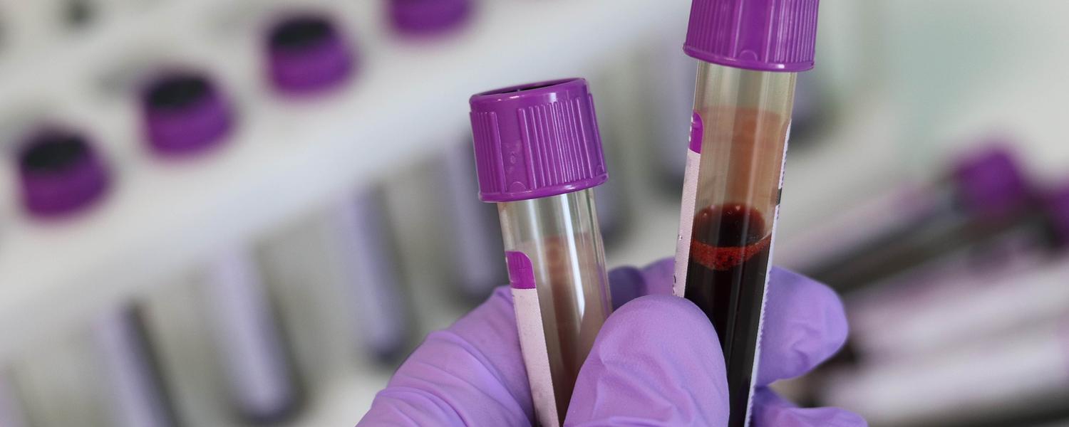 Blood tubes