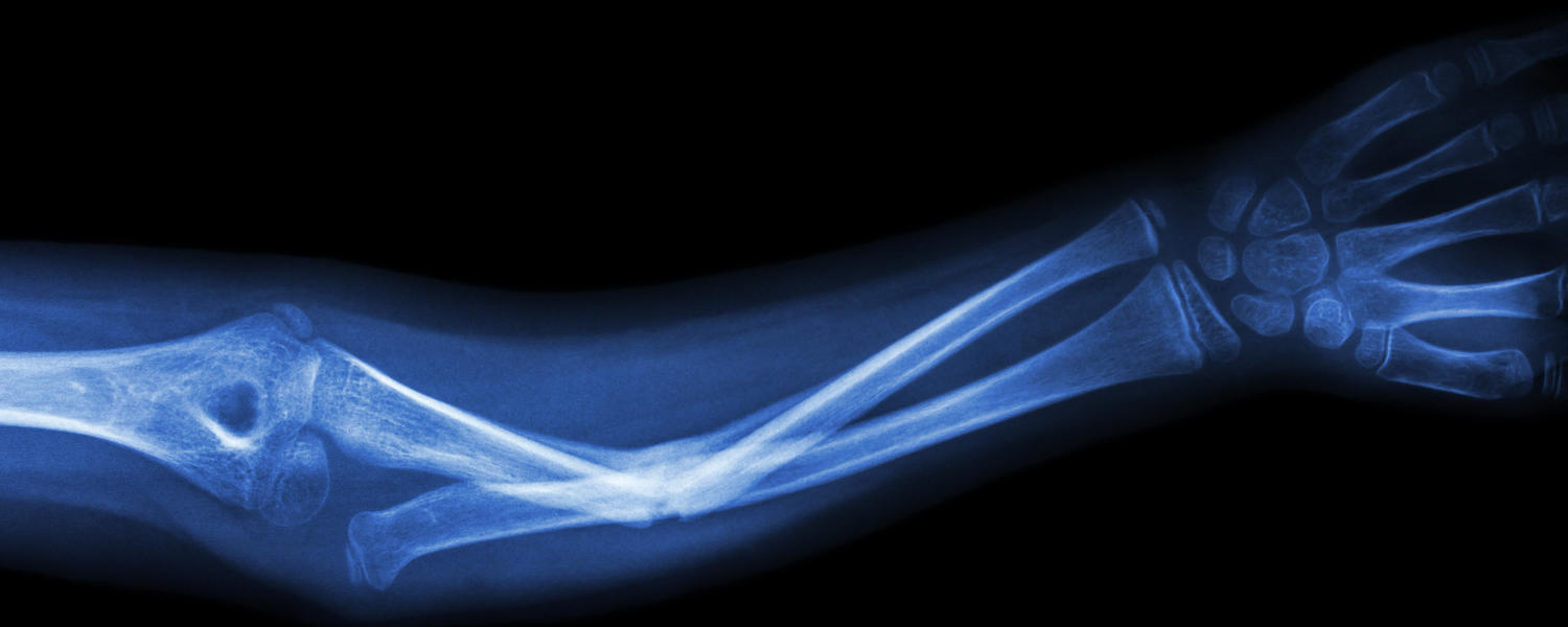 Arm Xray