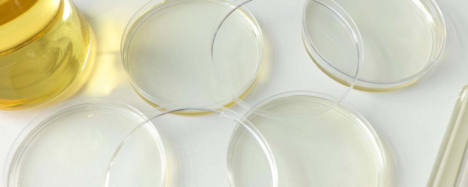Petri dishes for collecting samples