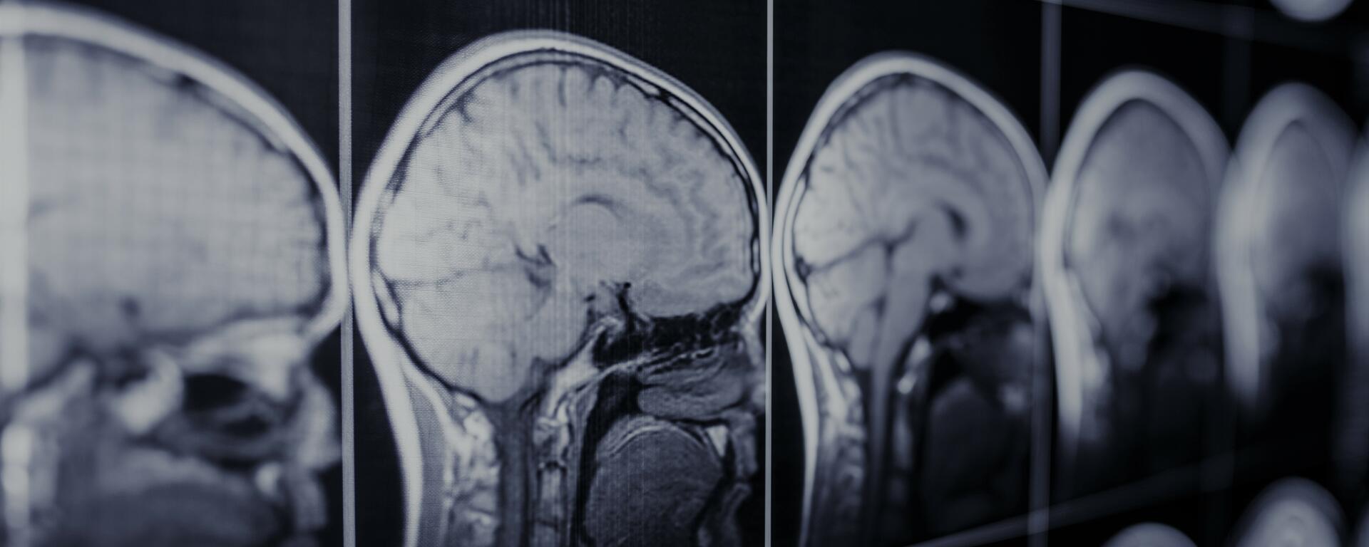 Research Studies Banner of MR Images