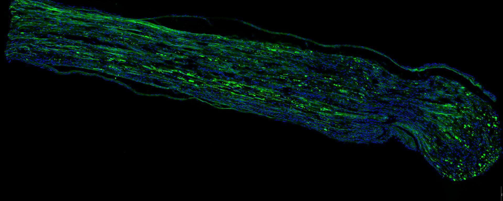 Peripheral nerve