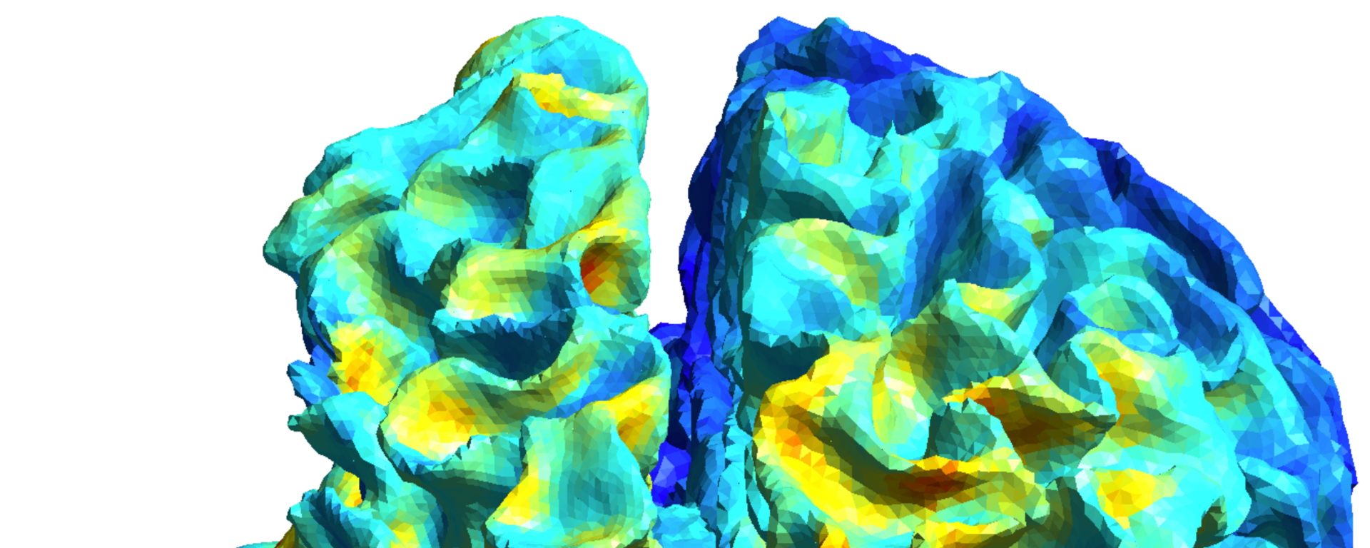 Brain imaging 