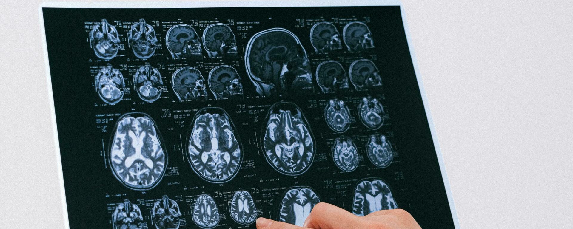 MRI