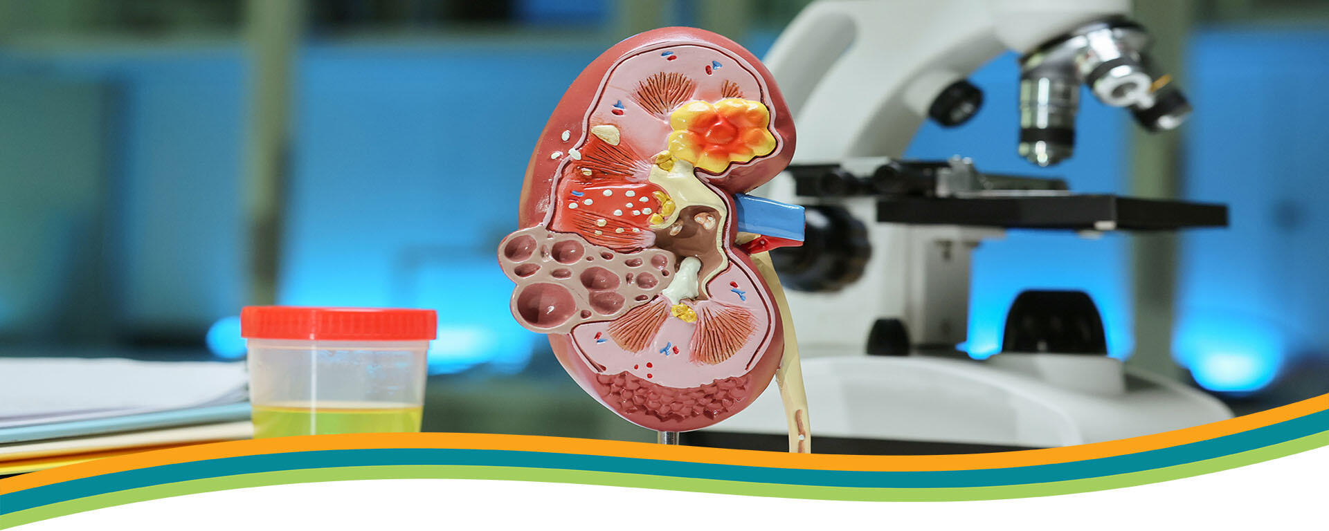 urine sample in front of a kidney model with a microscope in the background