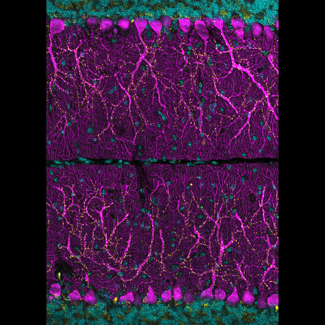 Purkinje cells & Pre-synapses