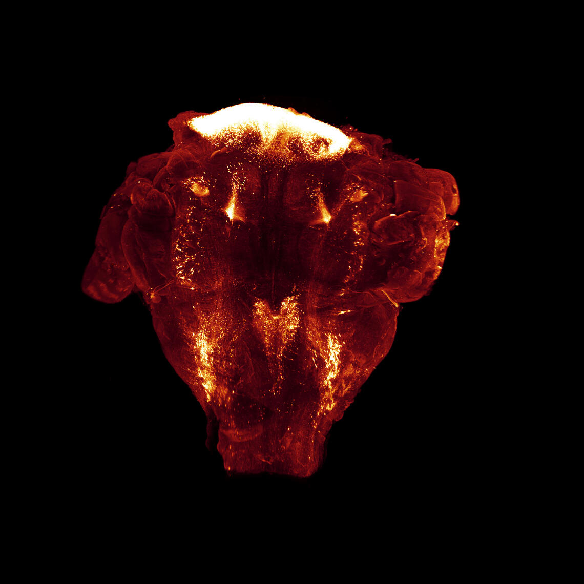 Brainstem