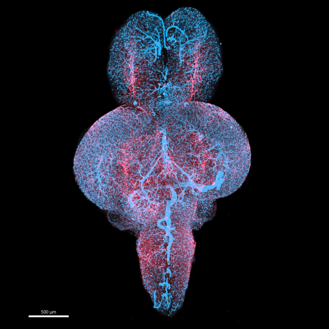 Microscopy image of zebrafish brain with red and pink colouring