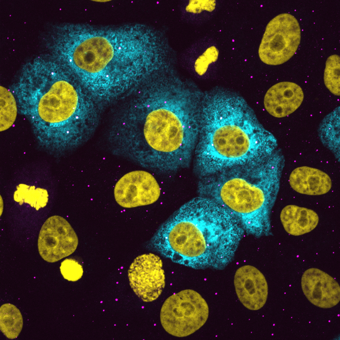 Black background with yellow nuclei. "Clouds" of blue SARS-CoV-2 RNA surround some of the nuclei