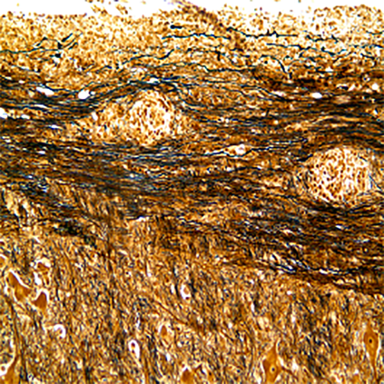 Nerve fibers