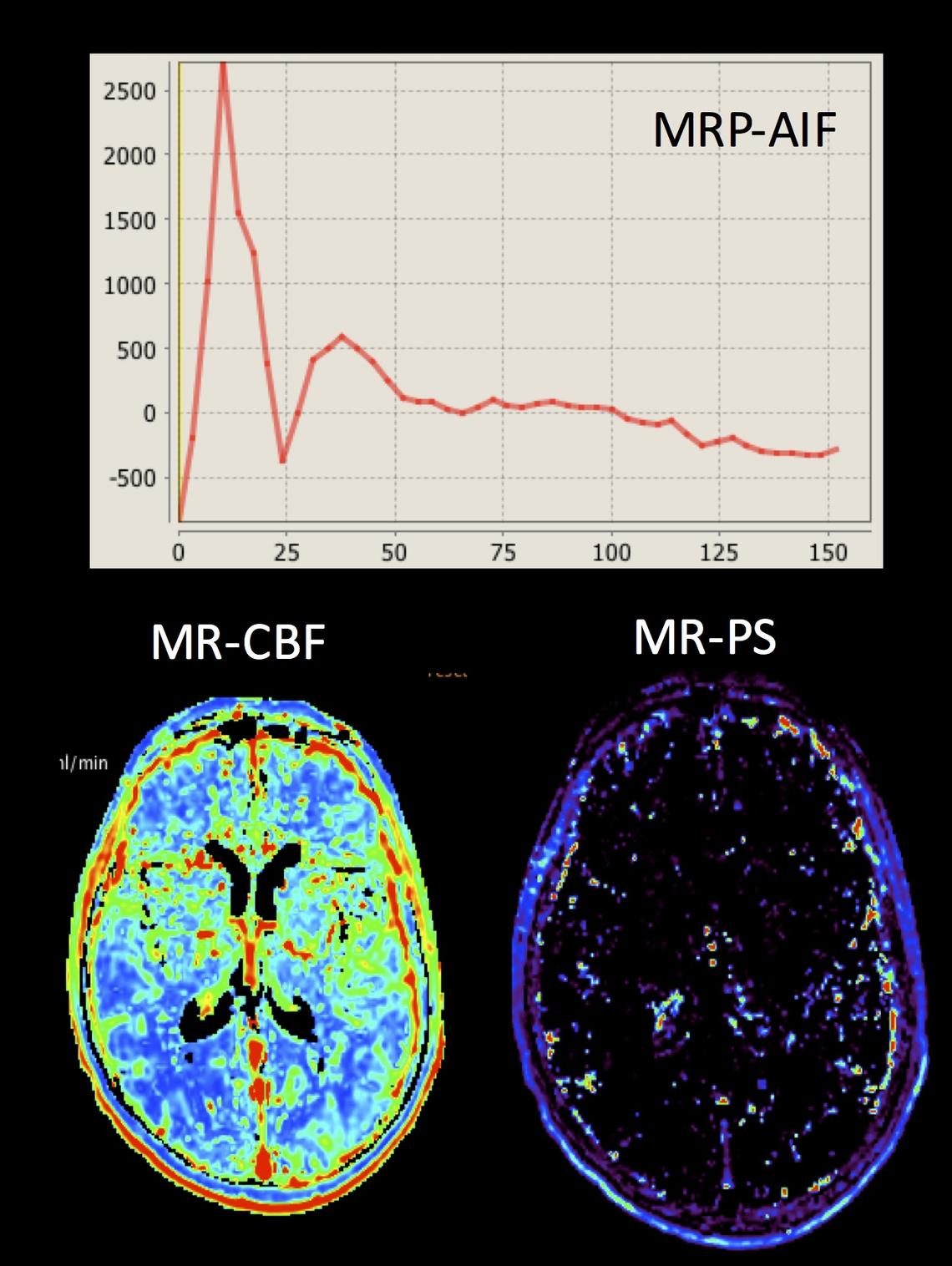 Perfusion