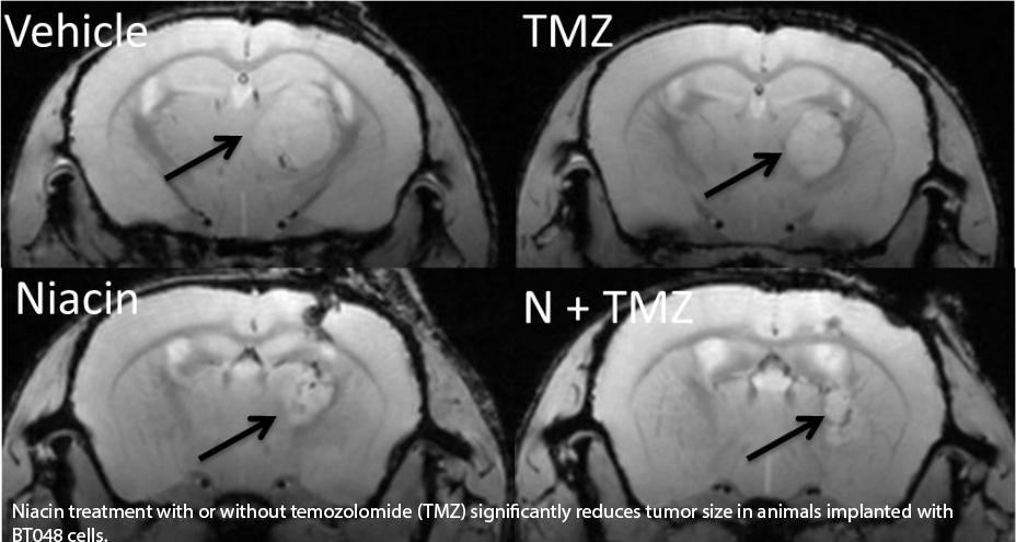 Niacin treatment with or without temozolomide (TMZ) significantly reduces tumor size in animals were implanted with BT048 cells.