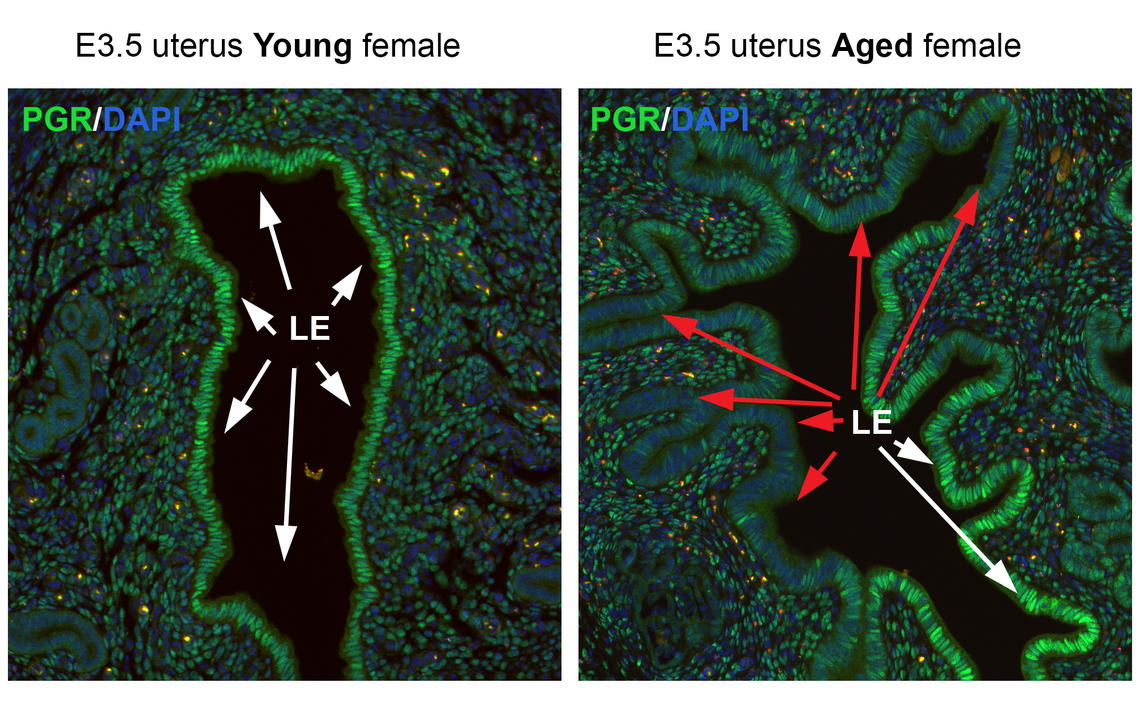 Progesterone receptor distribution in uteri of young and aged mouse females