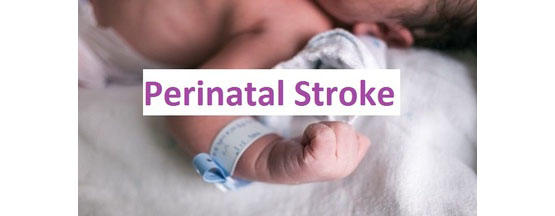 Perinatal stroke