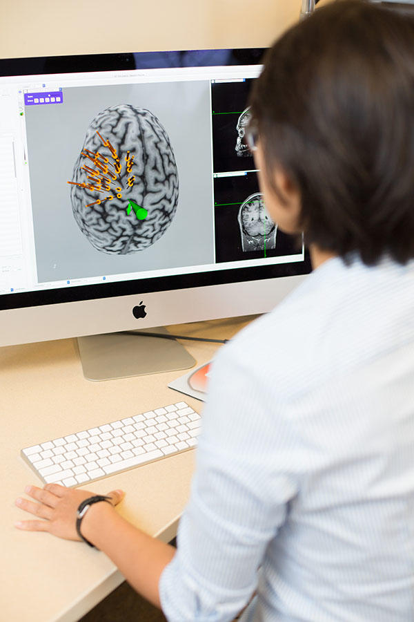 Transcranial Magnetic Stimulation (TMS)