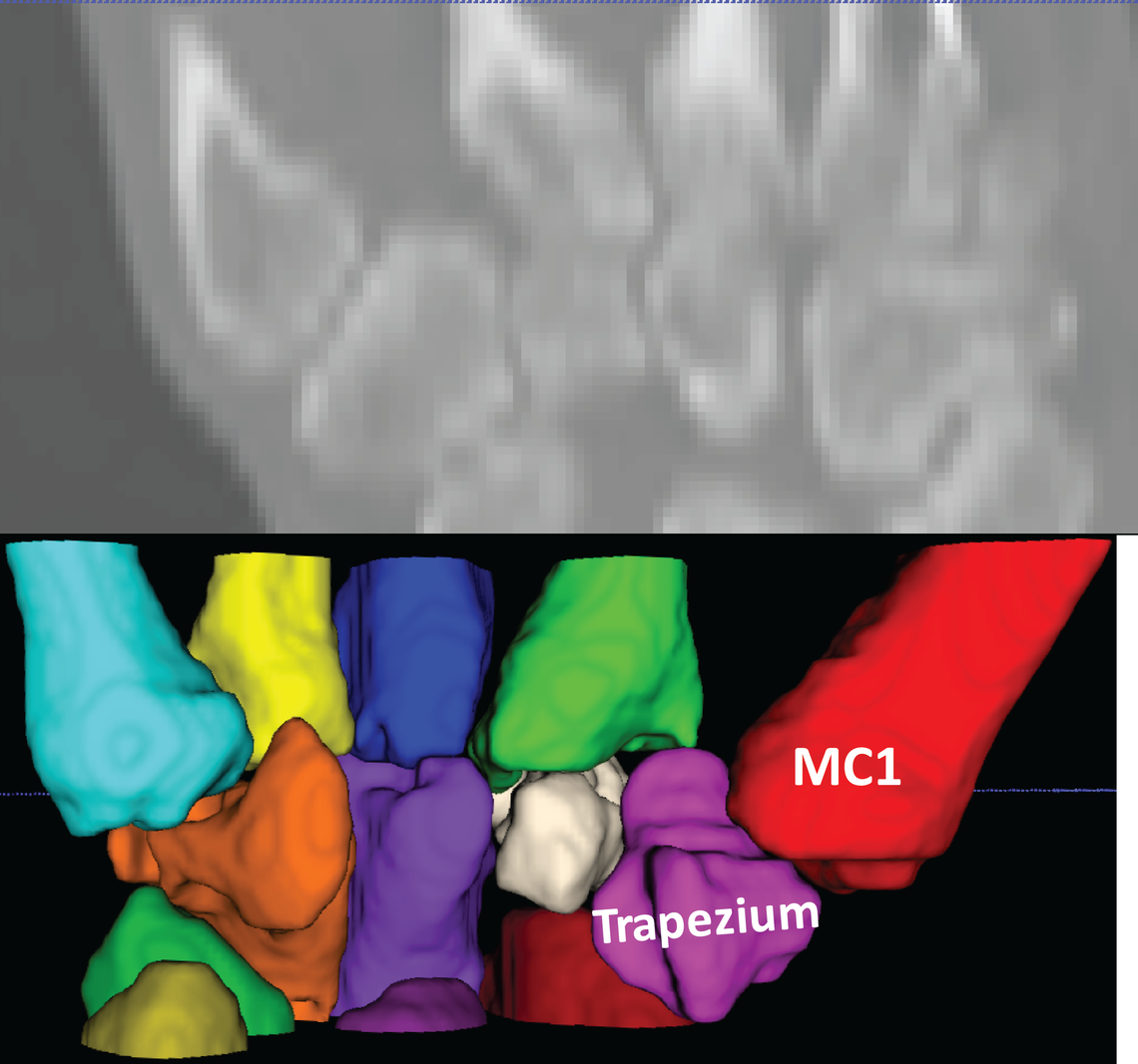 Hand Segmentation