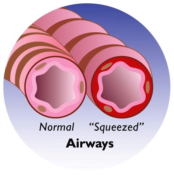 Relievers Lung image Relievers Lung image