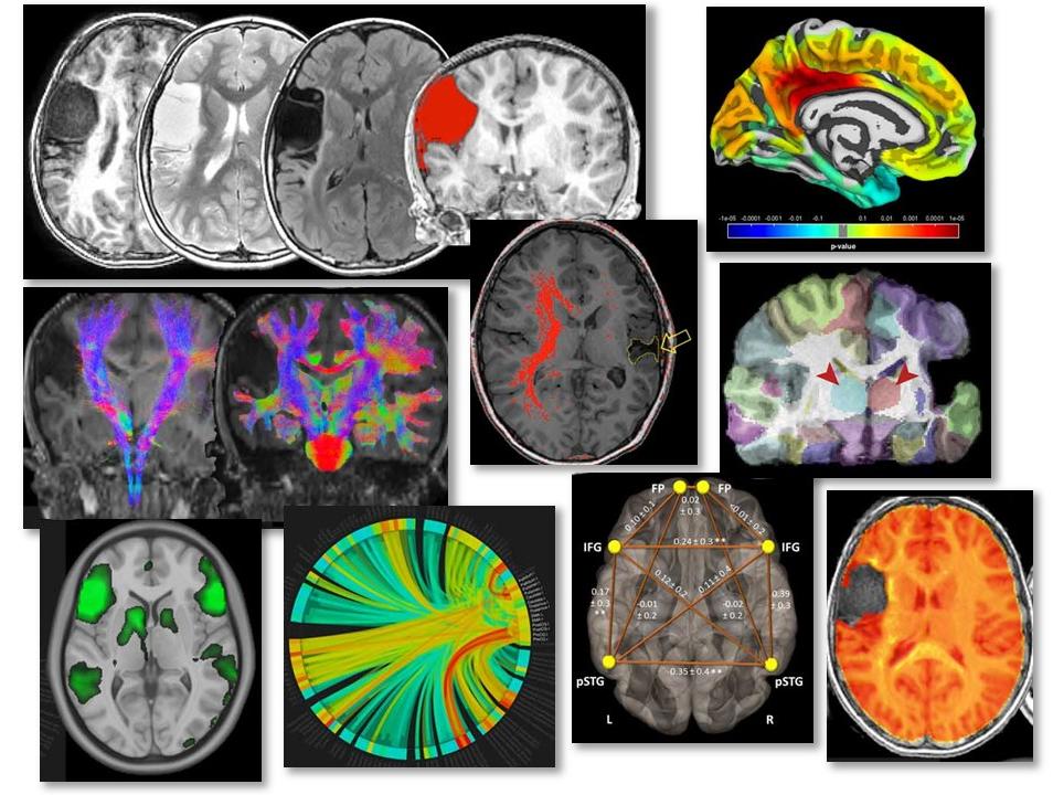 Advanced Neuroimaging