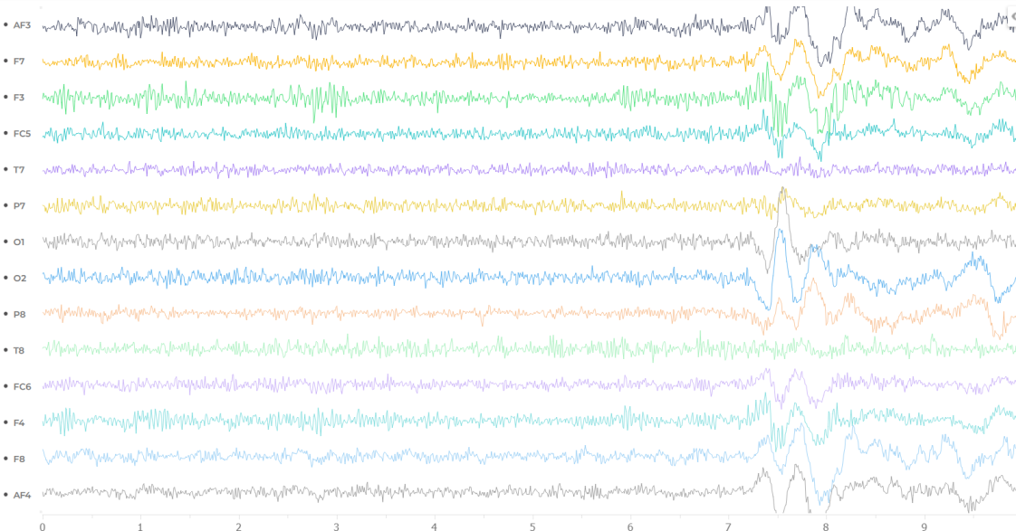 A graph showing electrical activity from the brain