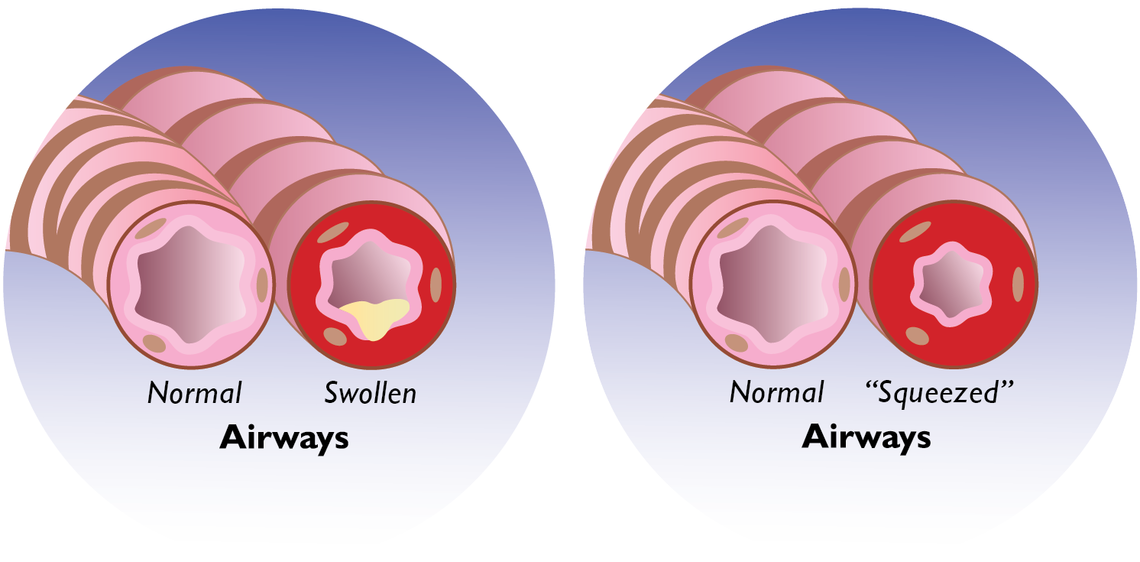 Lungs Lungs