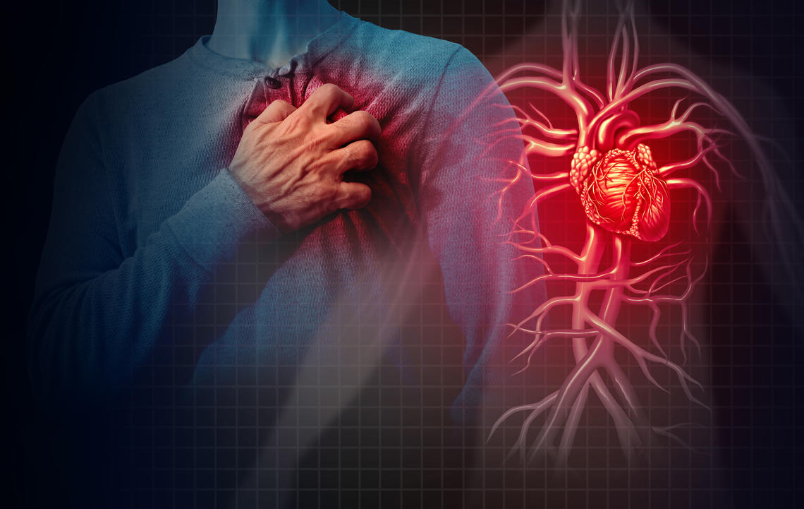Leveraging Machine Learning to Enable Precision Coronary Artery Disease Patient Care CA
