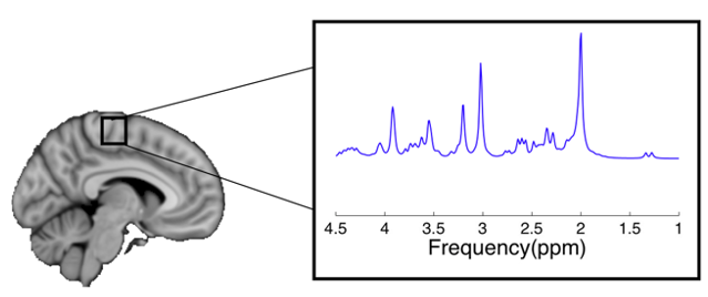 Brain metabolites