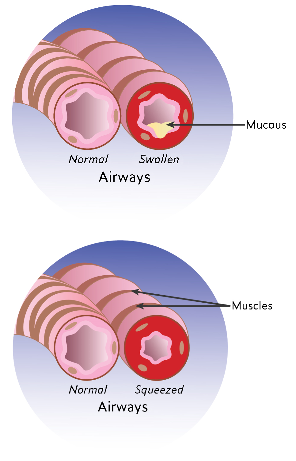 Lungs Lungs