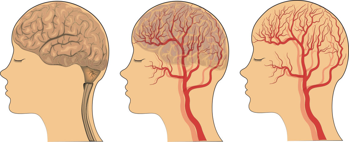 Interaction between Small Vessels and the Brain