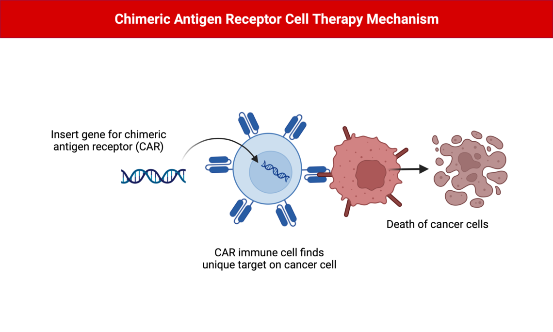 Illustration of a gene for a chimeric antigen receptor (CAR) being inserted into an immune cell to create a CAR immune cell. The CAR immune cell has now been programmed to find a unique target on cancer cells, and attack those cancer cells leading to the death of cancer cells. 
