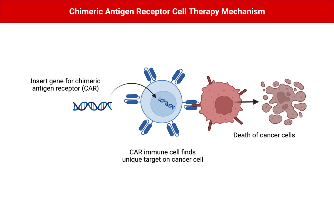 Illustration of a gene for a chimeric antigen receptor (CAR) being inserted into an immune cell to create a CAR immune cell. The CAR immune cell has now been programmed to find a unique target on cancer cells, and attack those cancer cells leading to the death of cancer cells.