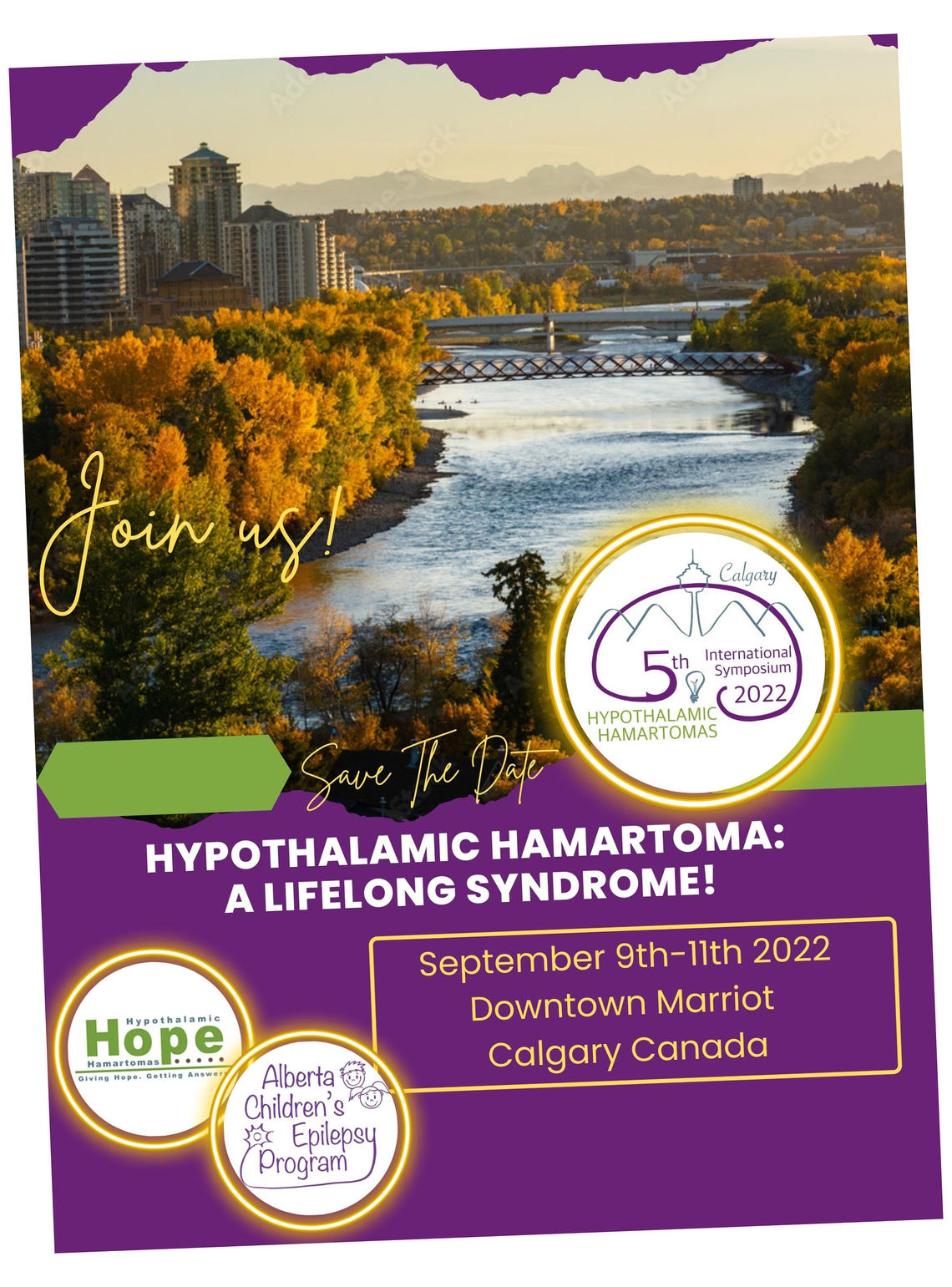 : Hypothalamic Harmatoma poster