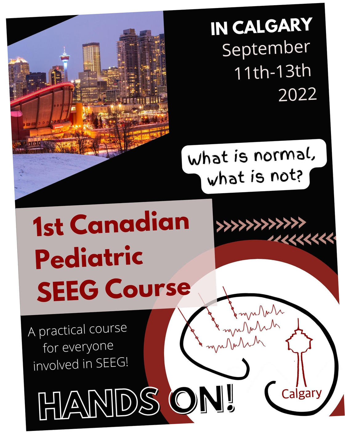 SEEG poster