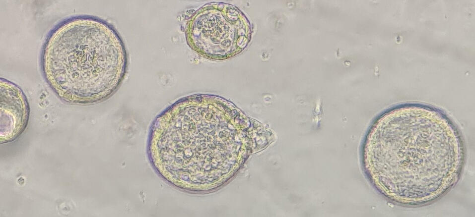 Mouse endometrial epithelial organoids