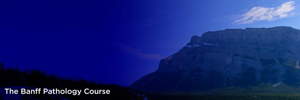 Lougheed mountain