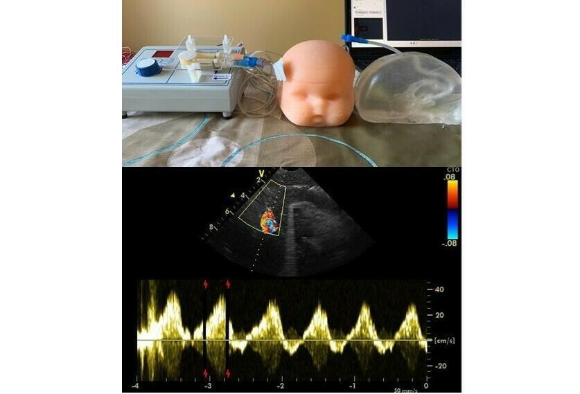 Cerebral Arteries Doppler Model