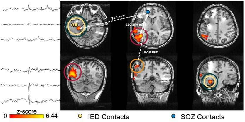 Sample EEG-fMRI