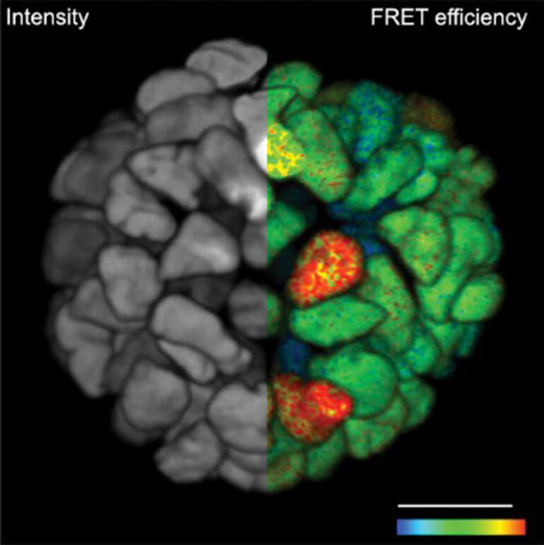 FRET Organoid